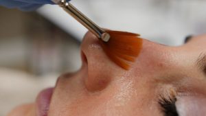 Chemical Peels