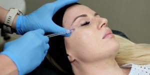 NCTF Eye Rejuvenation